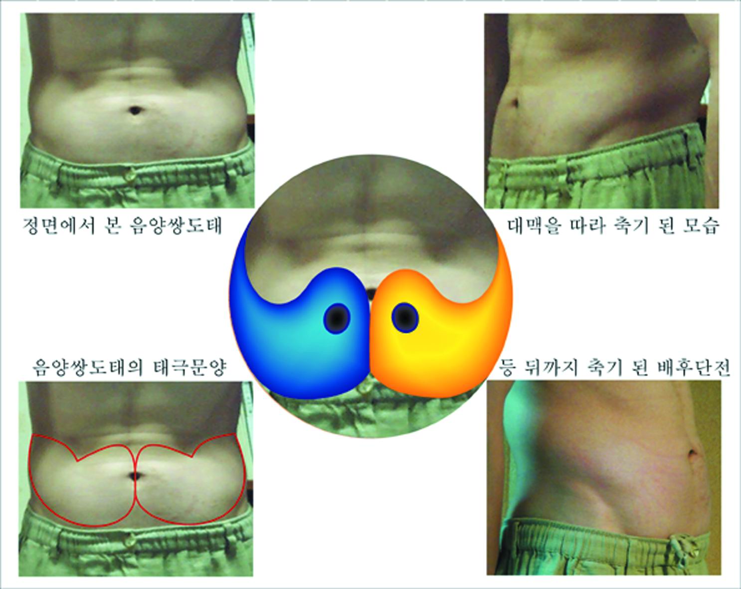 (선요가 쌍도태)